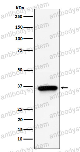 Anti-TIMM50 Antibody (R2H71)