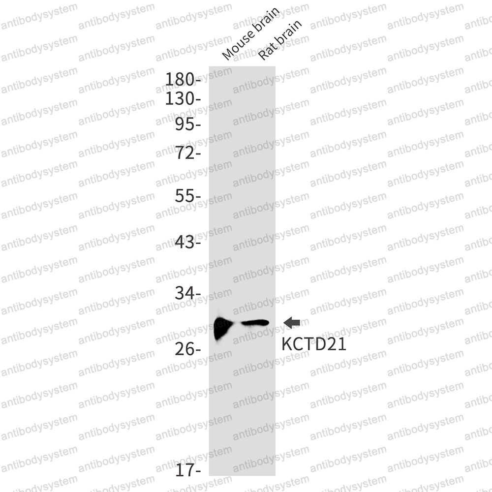 Anti-KCTD21 Antibody (R2H72)