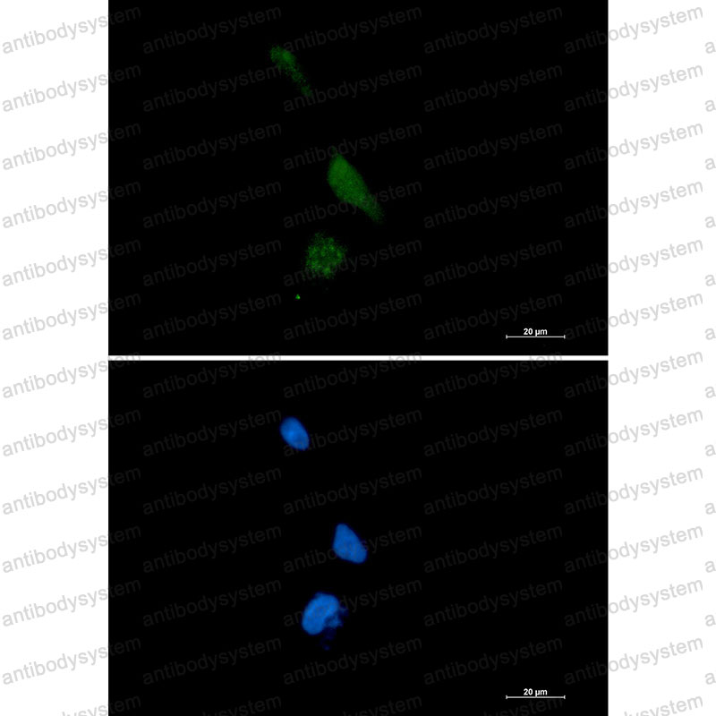 Anti-PREPL Antibody (R2H76)