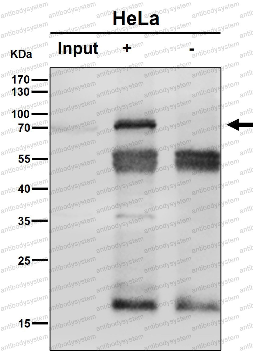 Anti-PREPL Antibody (R2H73)