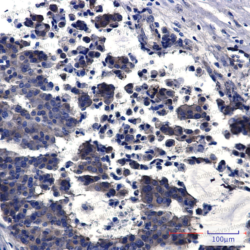 Anti-PREPL Antibody (R2H75)