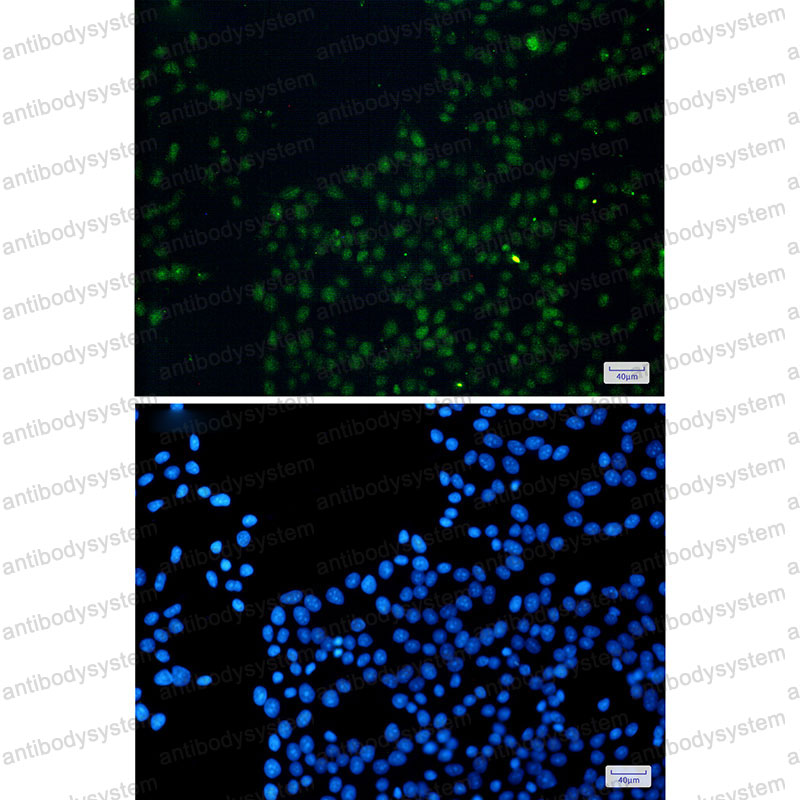 Anti-FAM98B Antibody (R2H77)