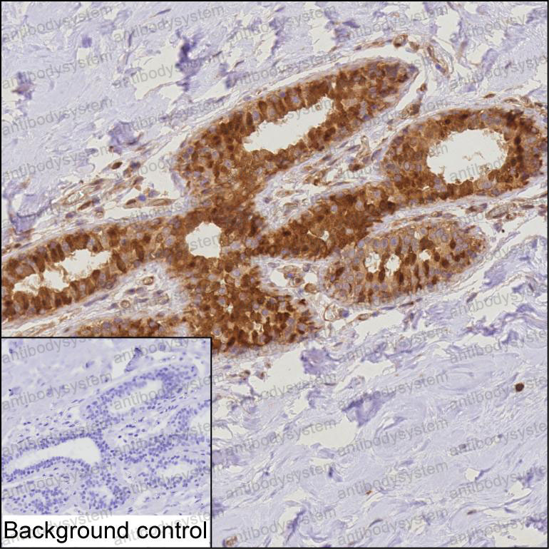 Immunohistochemical for Anti-PDCD4 Antibody (R3U84) ?>