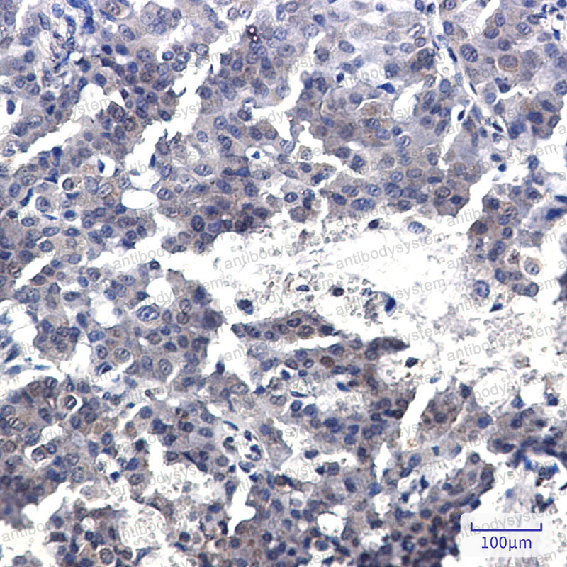 Anti-CRTC2 Antibody (R2H79)