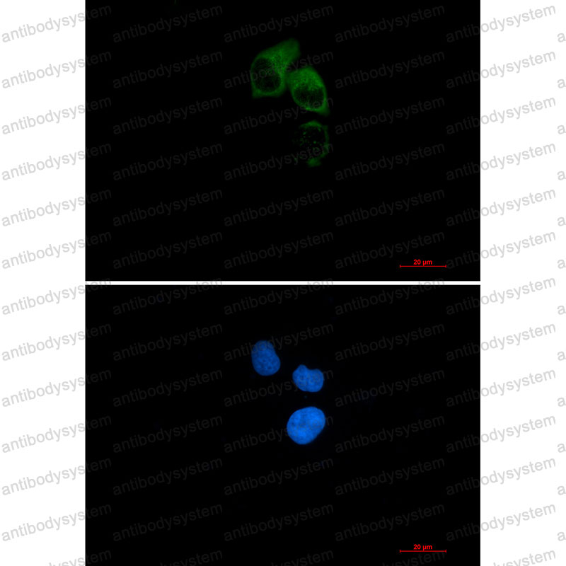Anti-CEP55 Antibody (R2H80)