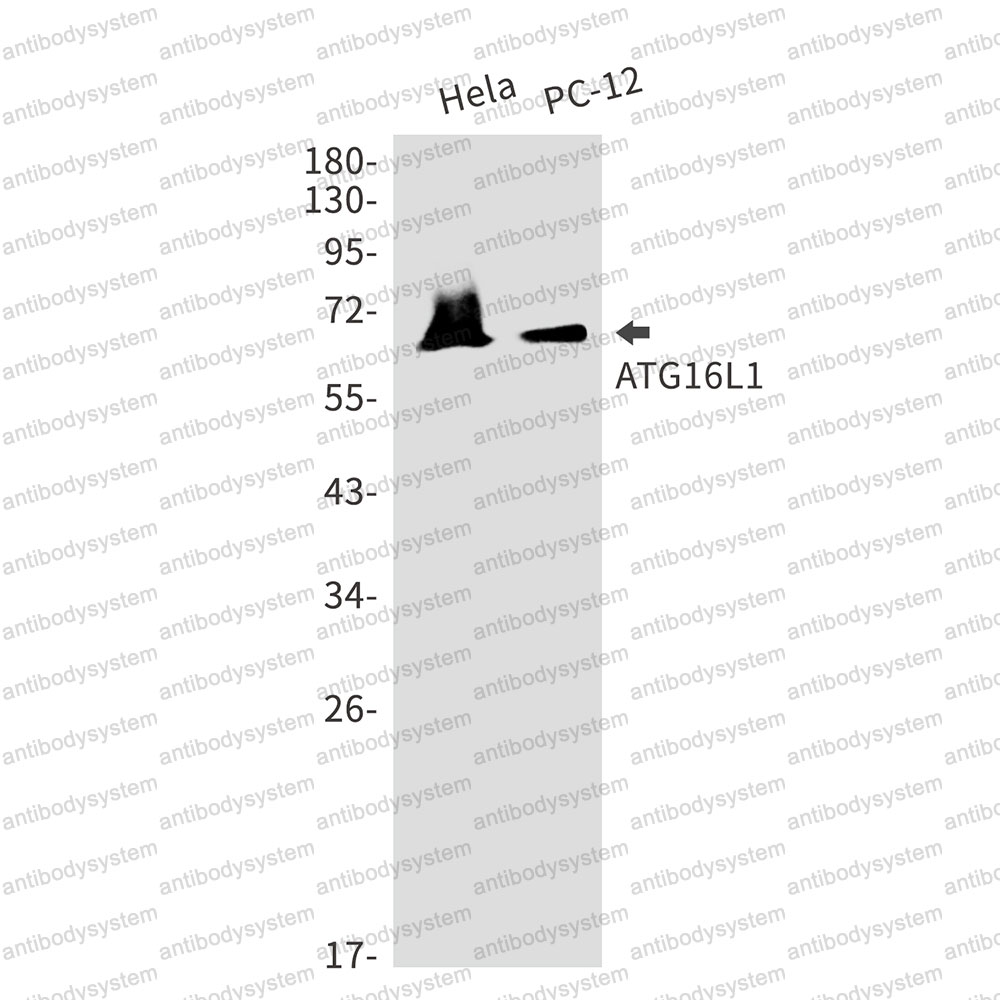 Anti-ATG16L1 Antibody (R2H84)