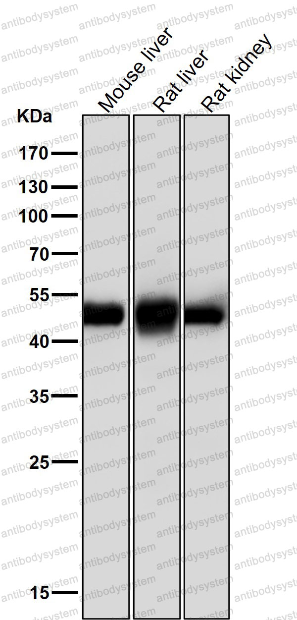 Anti-SFRP4 Antibody (R2H85)