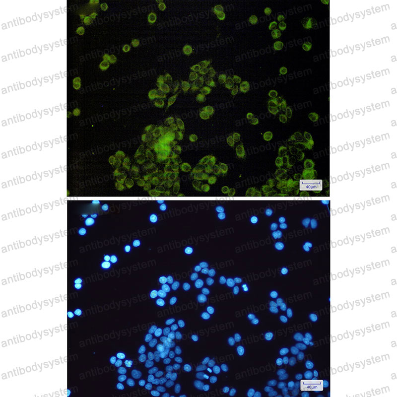 Anti-SLC27A4 Antibody (R2H87)