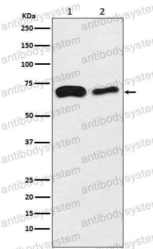 Anti-SLC27A4/FATP4 Antibody (R2H86)