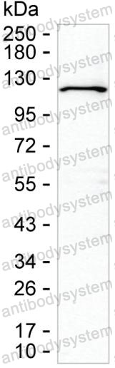 Western blot for Anti-CDw12/WDR59 Antibody (R3V01) ?>