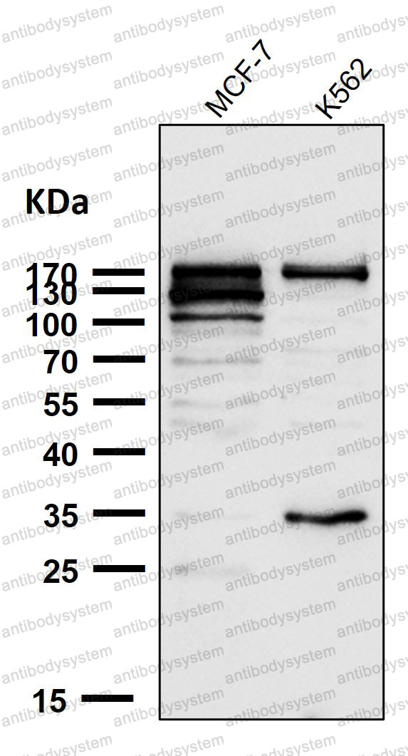 Anti-ATAD2 Antibody (R2H89)