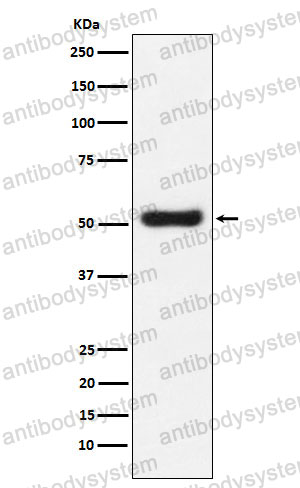 Anti-OLFM4 Antibody (R2H91)