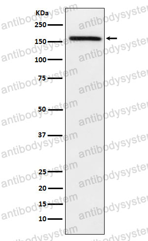 Anti-ADAMTS13 Antibody (R2H92)