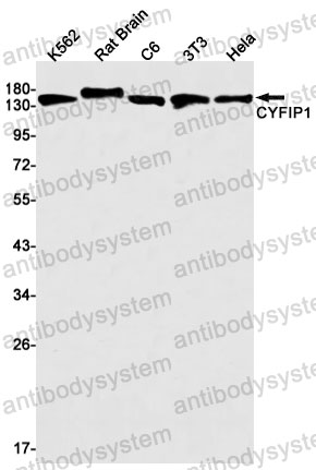 Anti-CYFIP1 Antibody (R2H94)