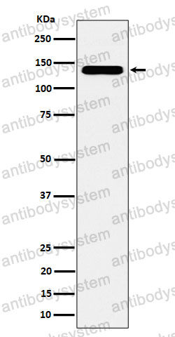 Anti-CYFIP1 Antibody (R2H93)