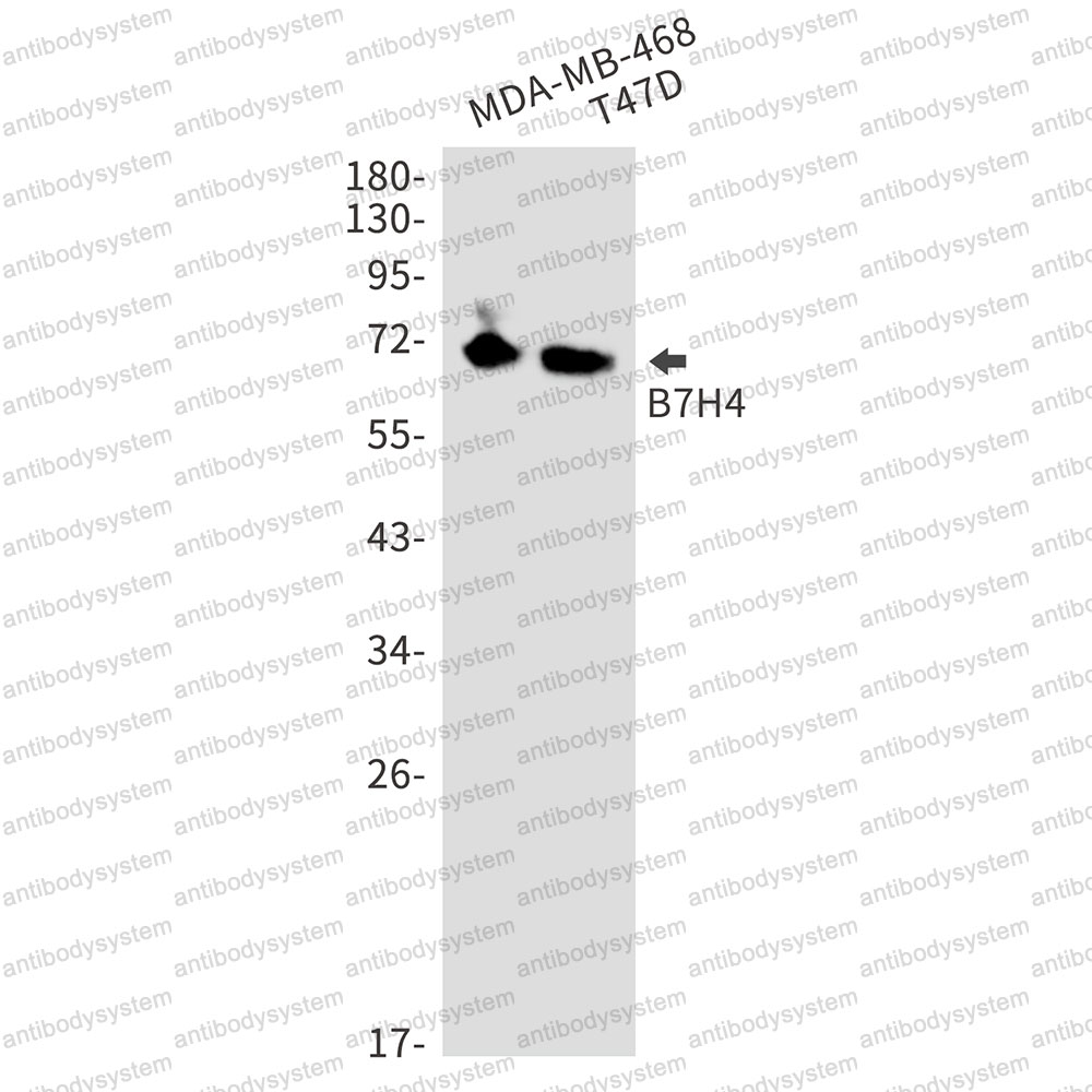 Anti-VTCN1/B7-H4 Antibody (R2H97)