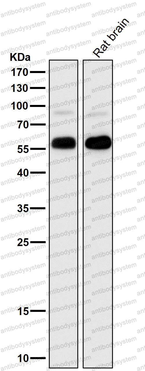 Anti-METTL3 Antibody (R2H98)