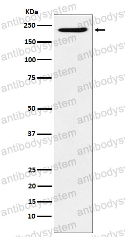 Anti-PBRM1 Antibody (R2H99)