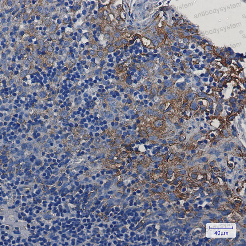 Anti-STING1/TMEM173 Antibody (R2J02)