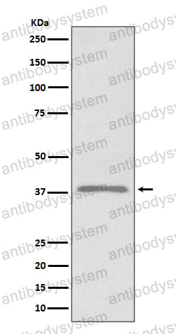 Anti-PDPN/Podoplanin Antibody (R2J04)