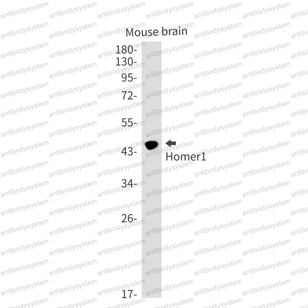 Anti-HOMER1 Antibody (R2J06)