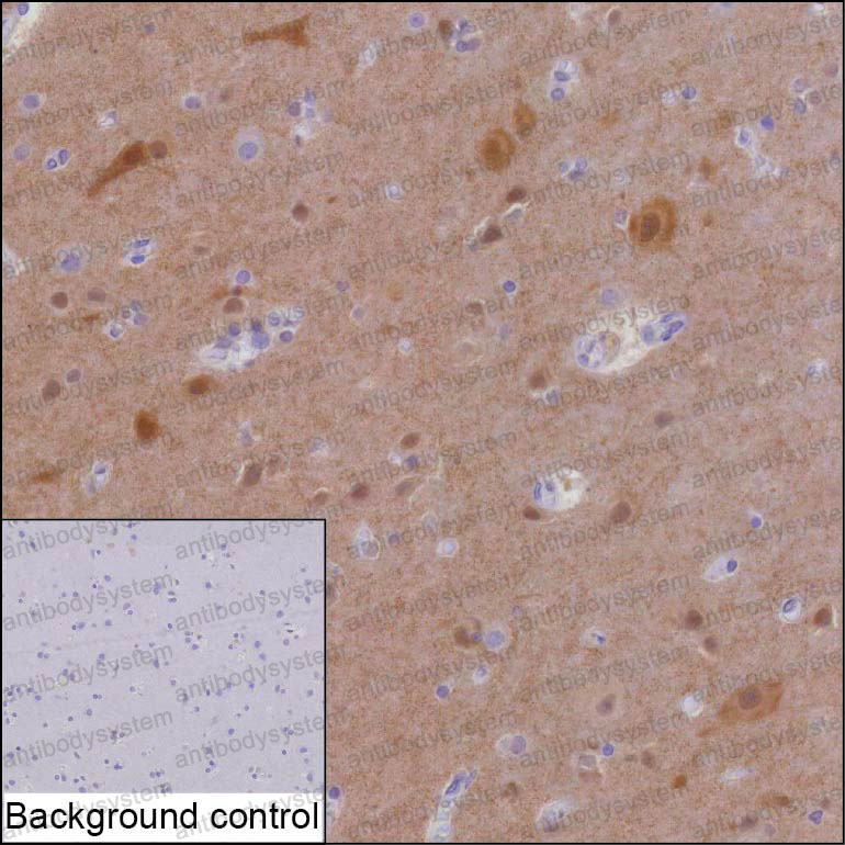 Immunohistochemical for Anti-HOMER1 Antibody (R3V28) ?>