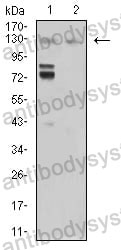 Western blot for Anti-MIB1 Antibody (R3V30) ?>