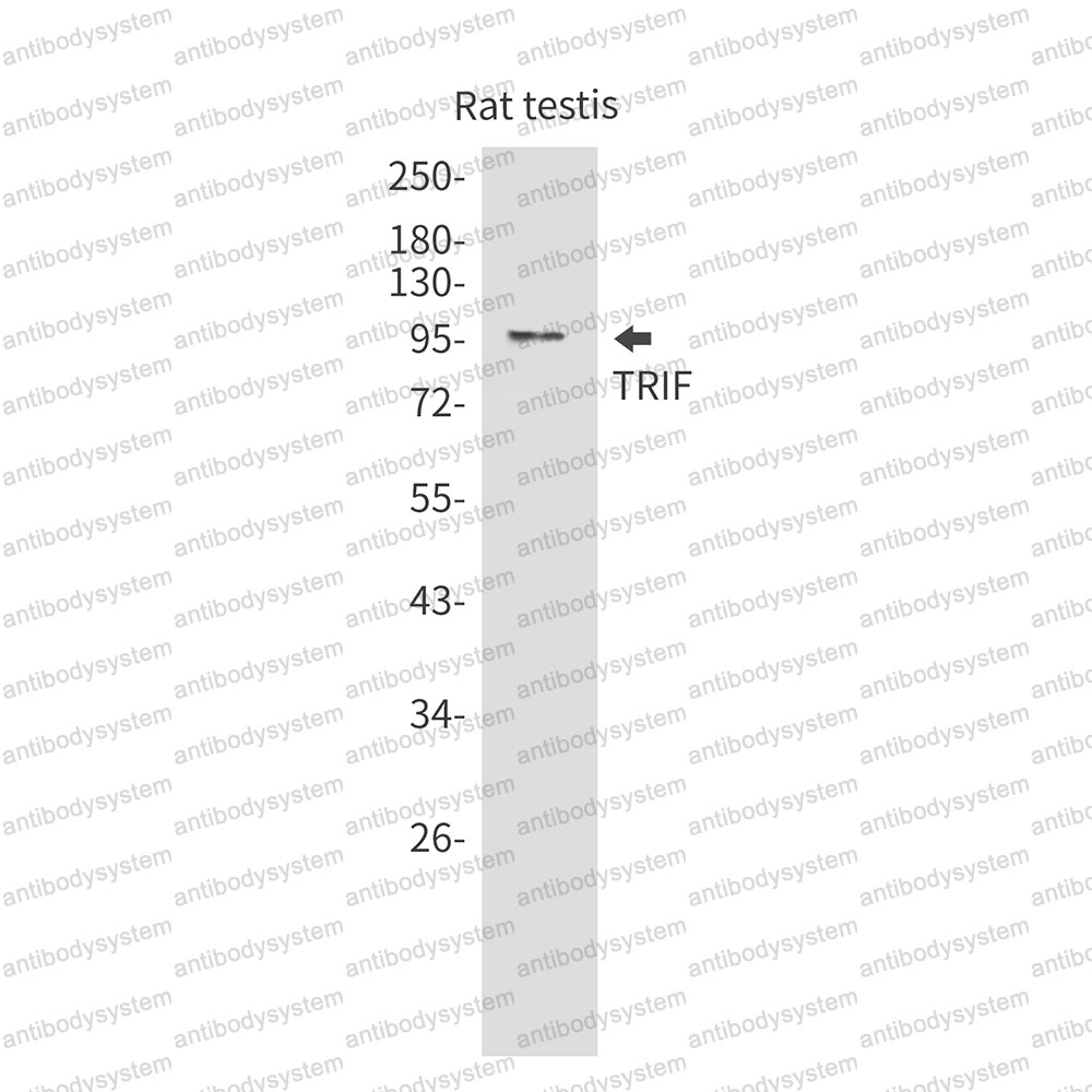 Anti-TICAM1 Antibody (R2J08)