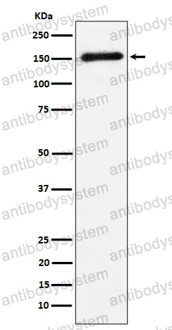 Anti-CNTN4 Antibody (R2J09)