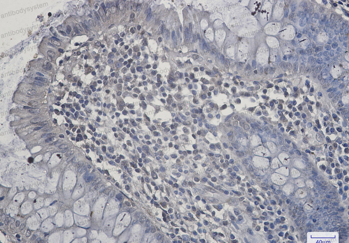 Anti-SIRT2 Antibody (R2J11)
