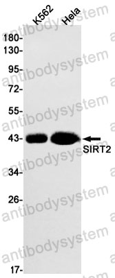 Anti-SIRT2 Antibody (R2J10)
