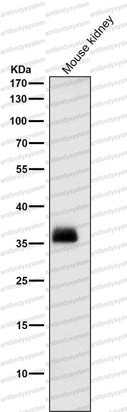 Anti-SFRP1 Antibody (R2J12)