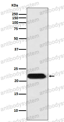 Anti-FTMT Antibody (R2J13)