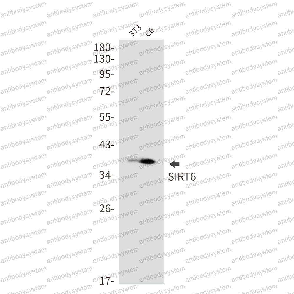 Anti-SIRT6 Antibody (R2J14)