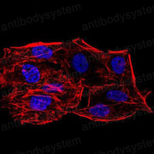 Immunofluorescence for Anti-SIRT6 Antibody (R3V39) ?>