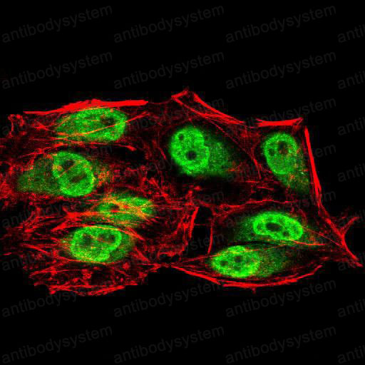 Immunofluorescence for Anti-SIRT6 Antibody (R3V39) ?>