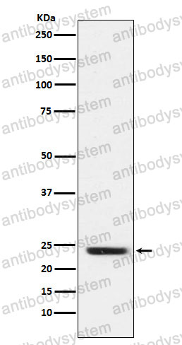 Anti-FNDC5 Antibody (R2J15)