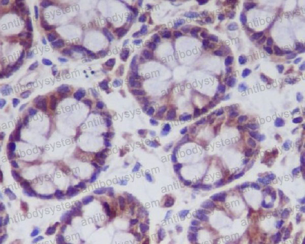 Anti-MLKL Antibody (R1C16)