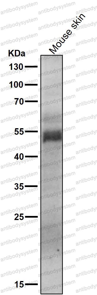 Anti-Phospho-MLKL (S358) Antibody (R2J17)