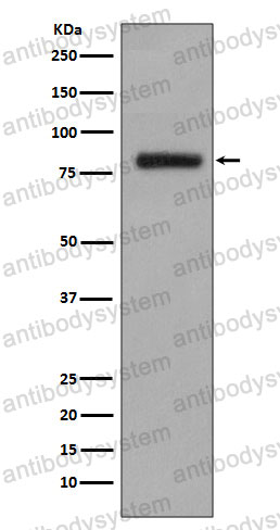 Anti-GOLM1/GP73 Antibody (R2J20)