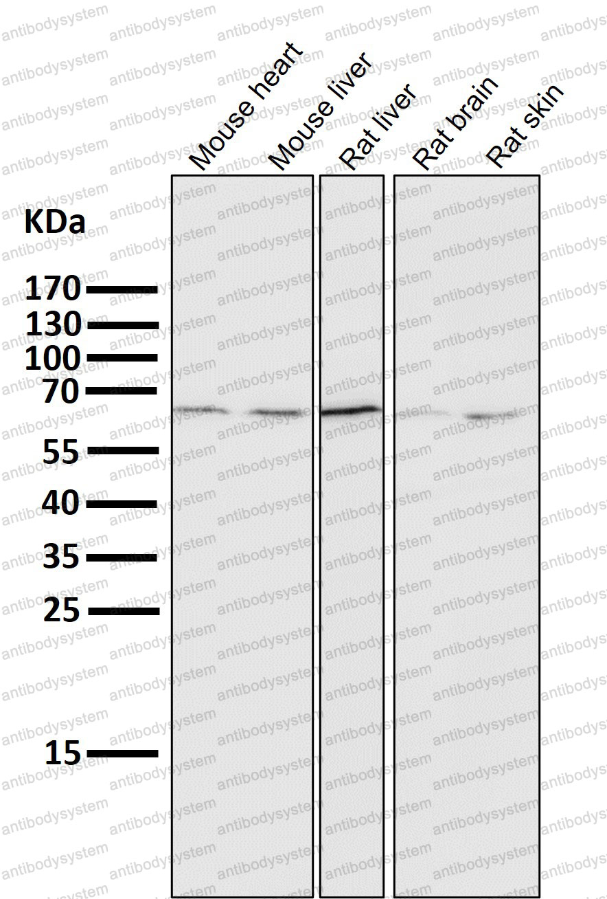 Anti-PCSK9 Antibody (R2J21)