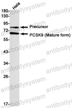Anti-PCSK9 Antibody (R2J22)
