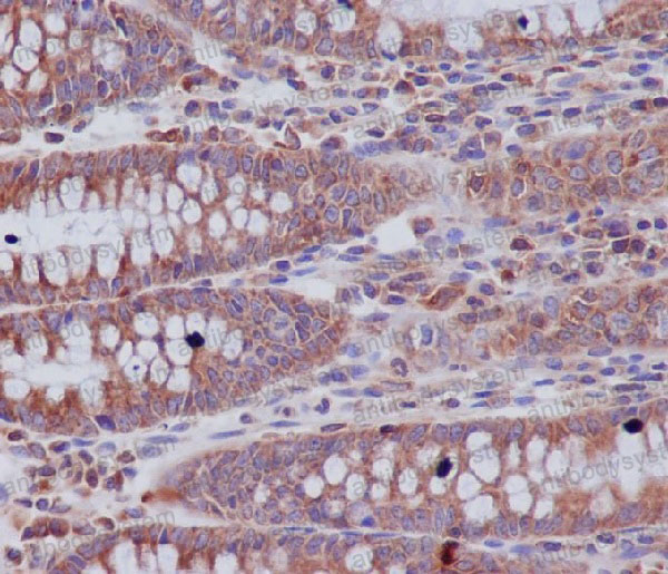 Anti-ABCF1 Antibody (R2J23)