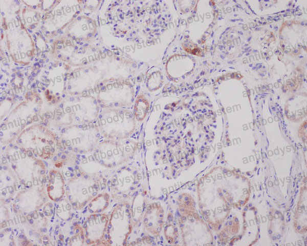 Anti-PIK3C3 Antibody (R1B29)