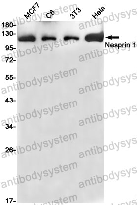 Anti-SYNE1 Antibody (R2J25)