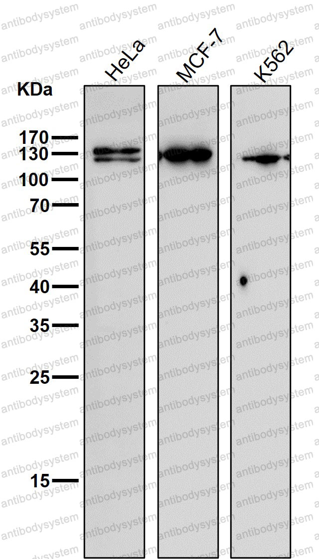 Anti-SYNE1 Antibody (R2J24)