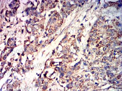 Immunohistochemical for Anti-CD85k/LILRB4/ILT3 Antibody (R3V42) ?>