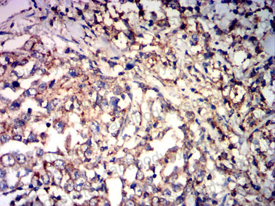 Immunohistochemical for Anti-CD85k/LILRB4/ILT3 Antibody (R3V42) ?>