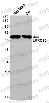 Anti-LRRC15/LIB Antibody (R2J27)