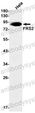 Anti-FRS2 Antibody (R2J29)